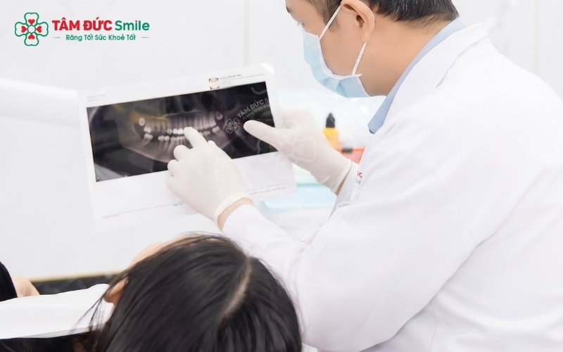 Quy trình nhổ răng khôn tại Tâm Đức Smile tuân thủ nghiêm ngặt nguyên tắc vô khuẩn, sử dụng công nghệ tiên tiến nhằm hạn chế sang chấn và tối ưu hóa thời gian hồi phục cho khách hàng.