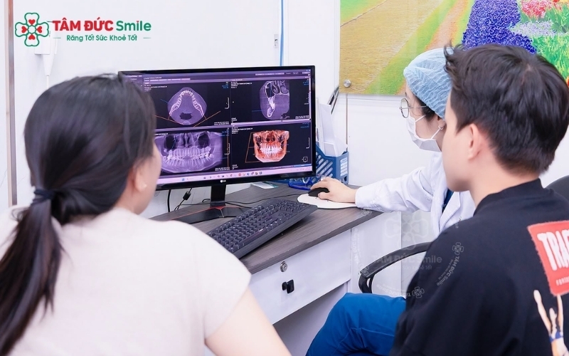 Bác sĩ xác định chính xác vị trí răng khôn và các cấu trúc thần kinh, đảm bảo quá trình nhổ răng diễn ra an toàn, kiểm soát tối đa các rủi ro.