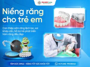Niềng răng cho trẻ em – Giải pháp chỉnh nha sớm, hiệu quả và an toàn