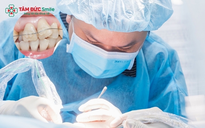 Hiện nay có nhiều giải pháp điều trị răng mọc lệch hiệu quả, từ niềng răng mắc cài đến khay trong suốt Invisalign dựa trên phác đồ điều trị chính xác của bác sĩ