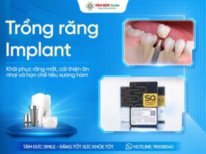 trong-rang-implant-8