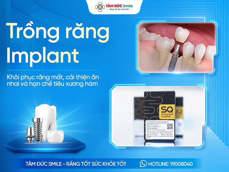 trong-rang-implant-8