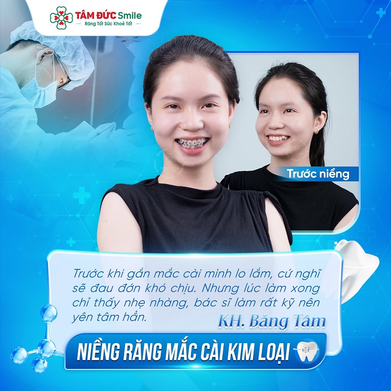Khách hàng cải thiện nụ cười với dịch vụ niềng răng tại Tâm Đức Smile.