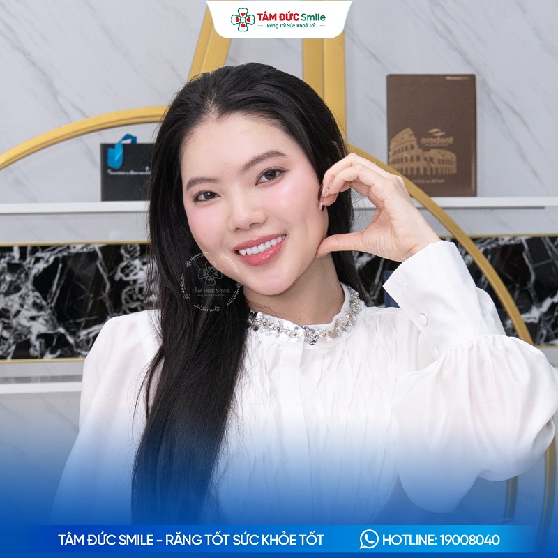 Khách hàng cải thiện nụ cười sau bọc răng sứ thẩm mỹ