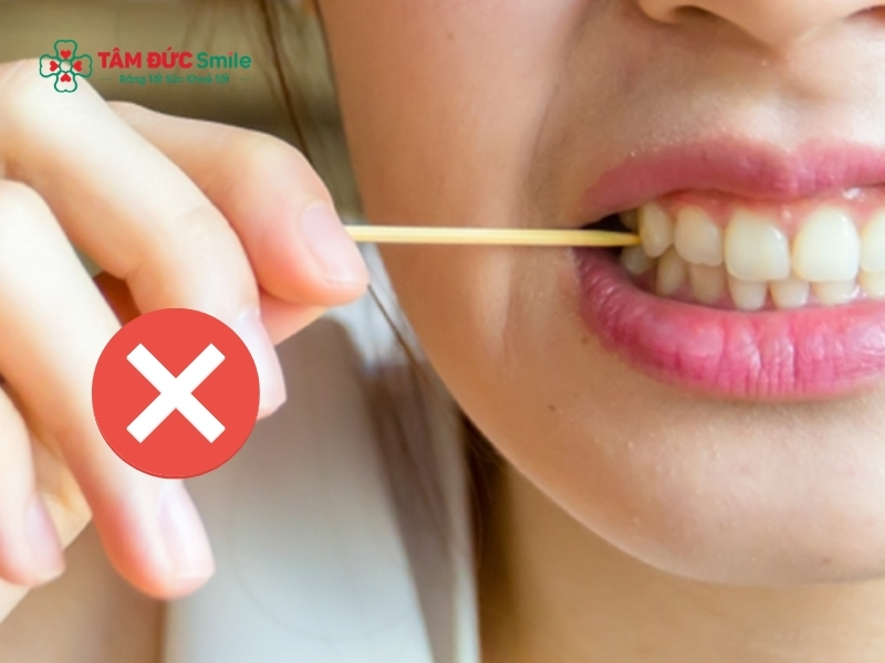 Tuyệt đối không dùng vật nhọn tự ý rạch nướu hoặc đắp các loại lá, gia vị mạnh trực tiếp lên vùng đau vì có thể gây bỏng nướu và nhiễm trùng máu.