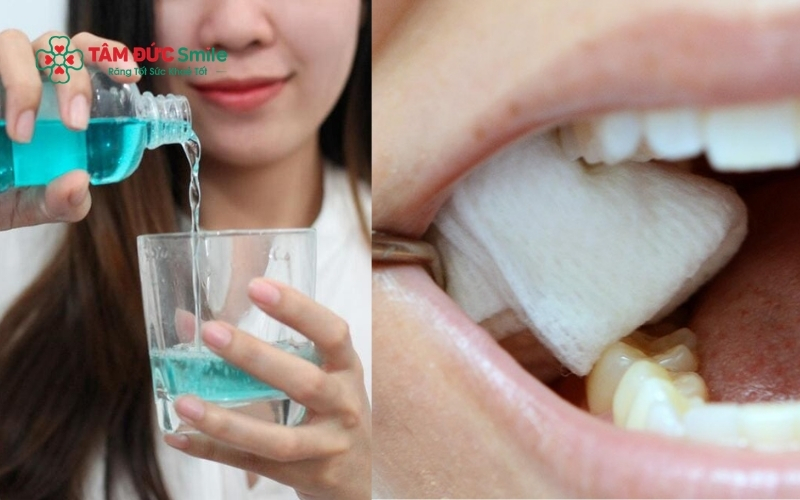 Cắn chặt gạc tại chỗ kết hợp vệ sinh răng miệng giúp co mạch và cầm máu nhanh chóng.