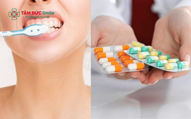 Vệ sinh răng miệng và dùng thuốc theo chỉ định phương pháp đơn giản nhưng hiệu quả để làm dịu cơn đau và giảm sưng tấy nhanh chóng.