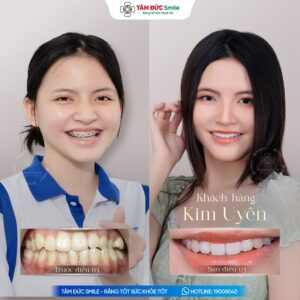 khach-hang-kim-uyen