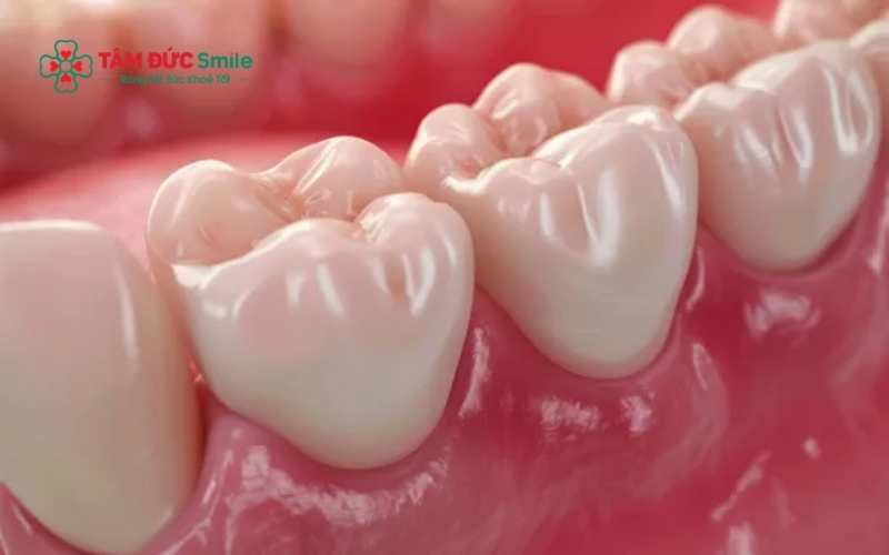 Tình trạng nướu sưng đỏ, tấy tấy và đau nhức là dấu hiệu điển hình của viêm lợi trùm răng số 8