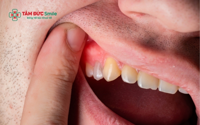 Đừng ngần ngại liên hệ hoặc đến gặp bác sĩ ngay nếu bạn gặp các dấu hiệu bất thường như chảy máu không ngừng hoặc đau nhức tăng dần sau 3 ngày
