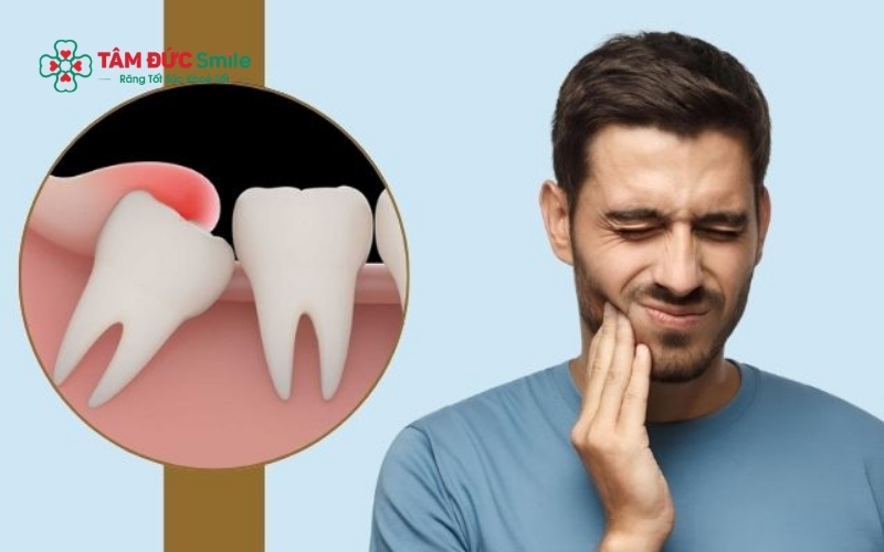Nếu vùng nướu quanh răng số 7 sưng đỏ kéo dài, có mủ hoặc mùi hôi, bạn cần đến bác sĩ ngay để kiểm tra nguy cơ nhiễm trùng hoặc viêm ổ răng.