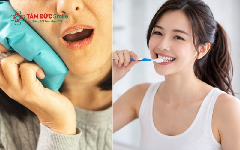 Chườm lạnh trong ngày đầu tiên là giải pháp hiệu quả giúp giảm sưng đau và đẩy nhanh quá trình hồi phục