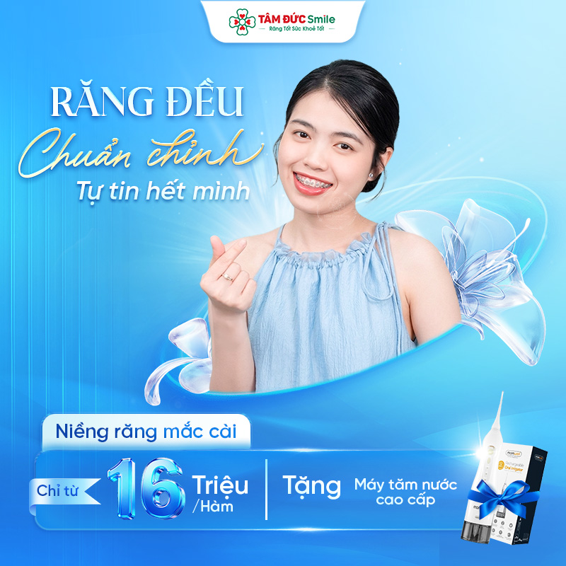 Niềng Răng Chuẩn Y Khoa –  Giá Ưu Đãi Chỉ Từ 16 Triệu/Hàm