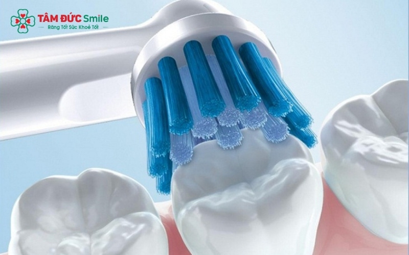 Để đảm bảo quyền lợi bảo hành, khách hàng cần tuân thủ chế độ chăm sóc và vệ sinh răng nhẹ nhàng