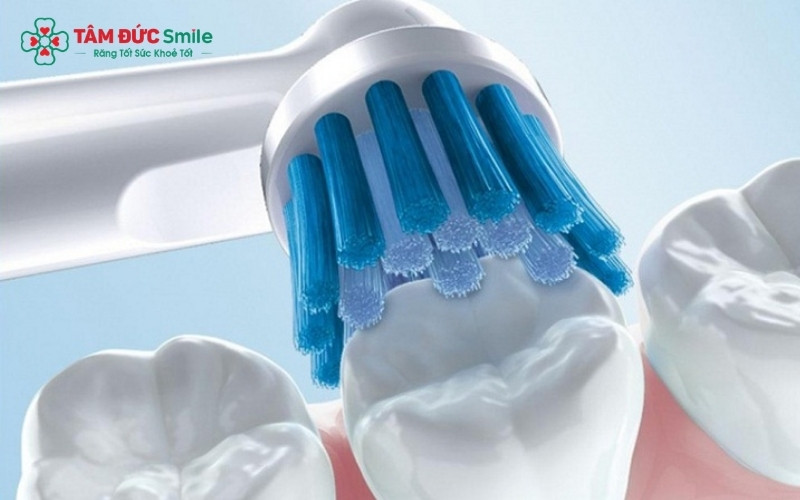 Súc miệng nước muối hay chườm lạnh chỉ có tác dụng giảm đau, kháng viêm tạm thời chứ không thể làm lỗ sâu răng hàm tự lành lại.