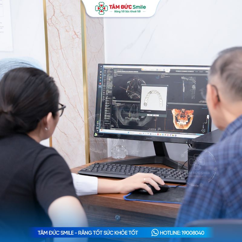 Bác sĩ đánh giá phim CT và tư vấn loại trụ, phương án phục hình cùng chi phí dự kiến trước điều trị.