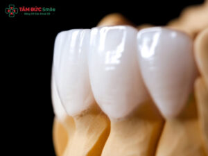 Dán răng sứ có hại không? Những ai không nên dán răng sứ Veneer?