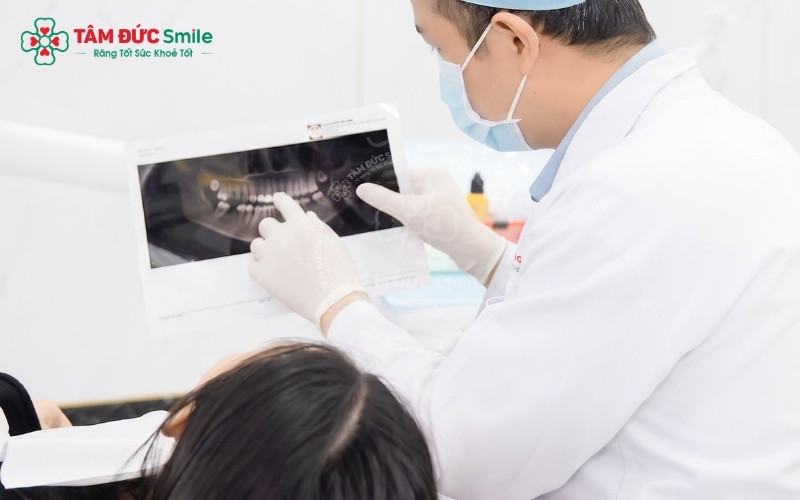 Chi phí và thời gian kéo răng khôn sẽ phụ thuộc vào mức độ phức tạp của từng ca cũng như công nghệ chỉnh nha được áp dụng.