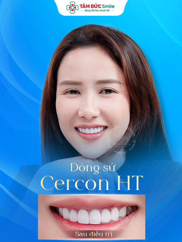 Ảnh trước