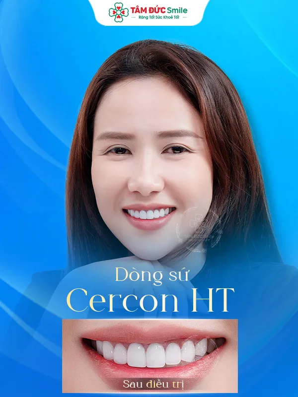 Ảnh trước