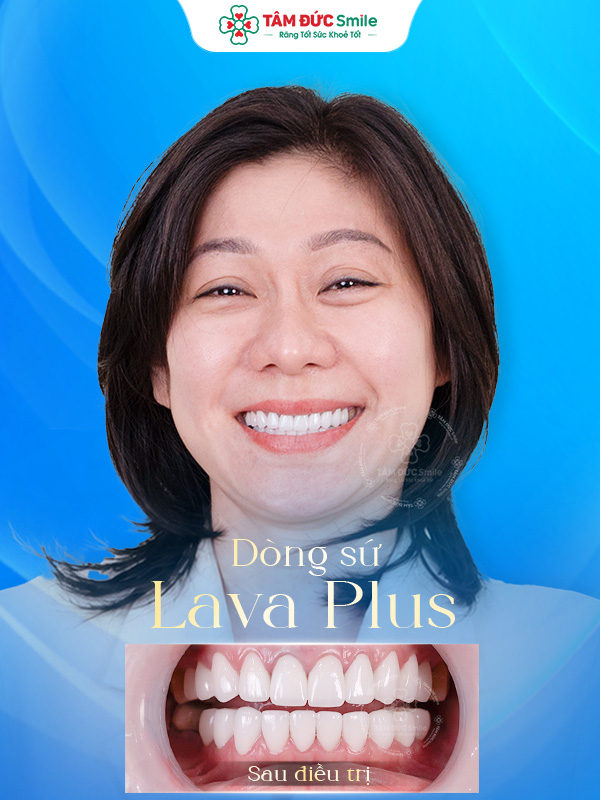 Ảnh trước