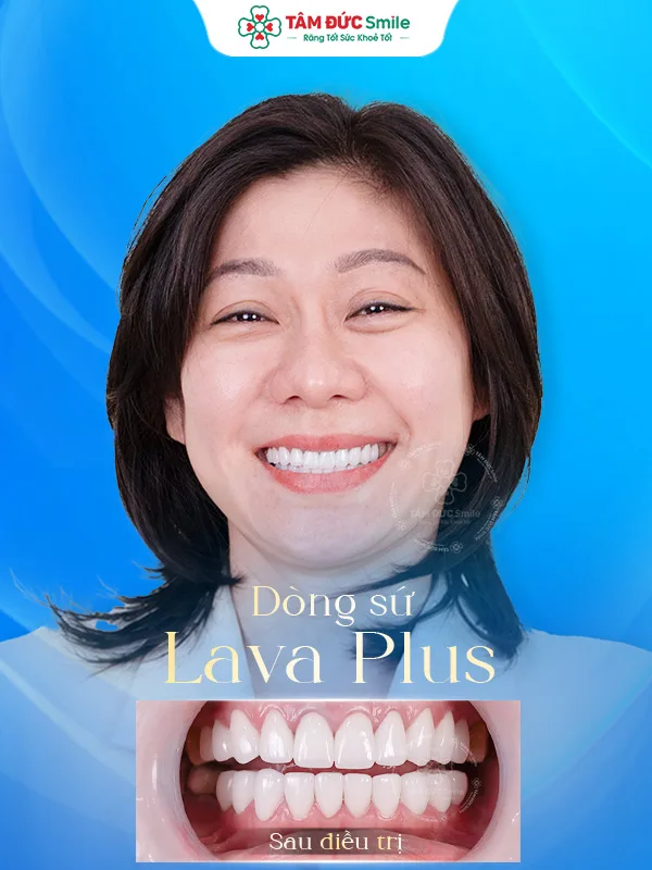 Ảnh trước