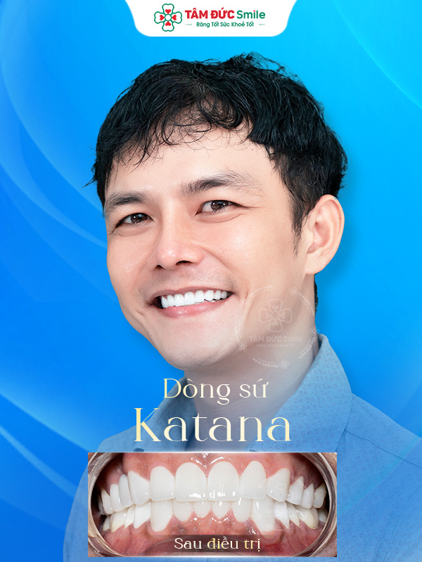 Ảnh trước