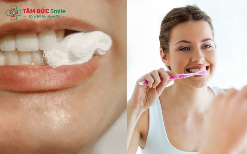 Cắn gạc cầm máu và chế độ chăm sóc, ăn uống trong những ngày đầu sau nhổ răng để vết thương nhanh khép miệng