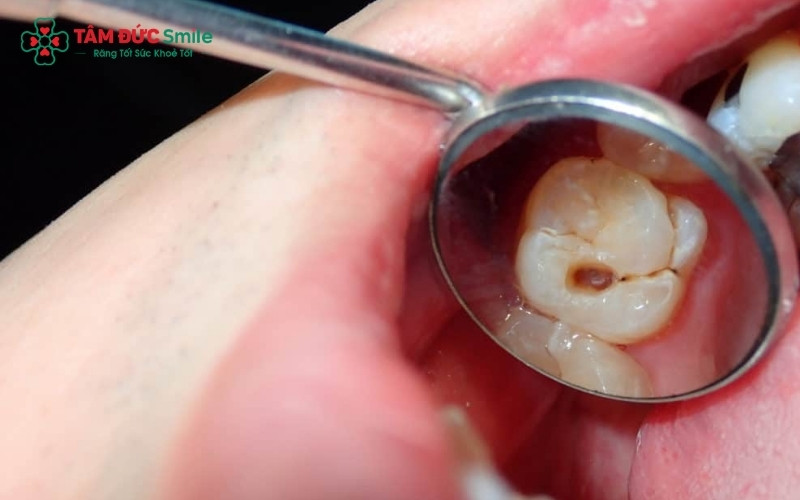Một cơ sở nha khoa an toàn cần đảm bảo yếu tố vô trùng tuyệt đối và trang bị đầy đủ máy móc hiện đại để xử lý các ca răng khôn phức tạp.