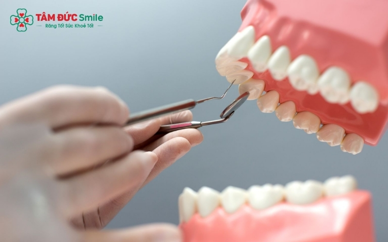 Nhờ kỹ thuật gây tê hiện đại, quá trình mài răng làm cầu sứ diễn ra hoàn toàn nhẹ nhàng, giúp bệnh nhân cảm thấy thoải mái và không đau đớn.