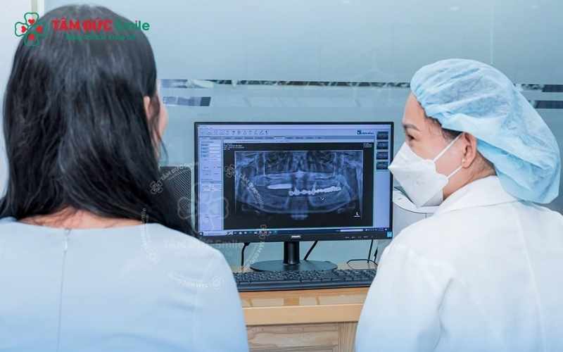 Bác sĩ khuyên vệ sinh răng miệng kỹ lưỡng giúp mẹ bầu ngăn ngừa các bệnh lý về nướu, bảo vệ xương hàm và tạo điều kiện thuận lợi cho việc cấy Implant sau này.