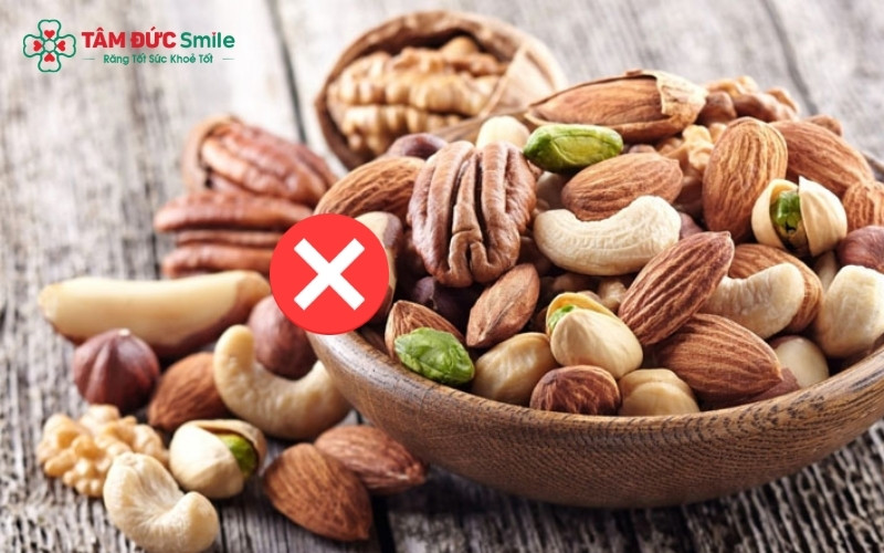 Bên cạnh việc chọn món ăn mềm, bạn cần tuyệt đối tránh đồ cứng, cay nóng và các chất kích thích để bảo vệ quá trình khép miệng của vết thương.