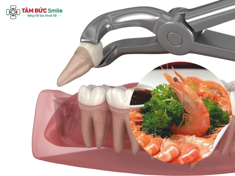 Nhổ răng khôn ăn tôm được không?