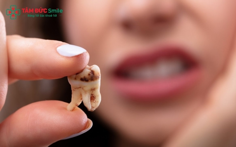Đau khi nuốt là phản ứng thường gặp do vùng nhổ răng khôn nằm rất gần các cơ họng