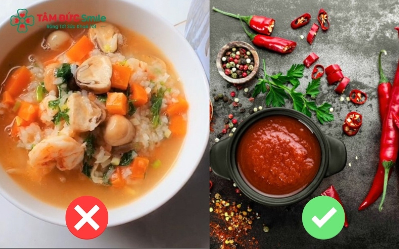 Duy trì chế độ ăn mềm, tránh thực phẩm cay nóng trong những ngày đầu giúp vết thương nhanh lành và giảm tình trạng sưng nề sau khi nhổ răng.