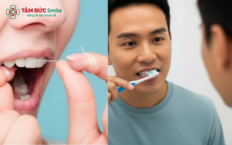 Vệ sinh răng miệng đúng cách và hạn chế nhai vật cứng tại vị trí trám giúp kéo dài tuổi thọ cho miếng trám