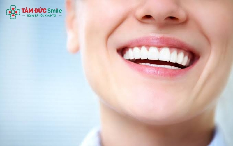 Với độ trong mờ tự nhiên và khả năng tương thích sinh học tuyệt vời, răng sứ Bio giúp mang lại nụ cười rạng rỡ mà không gây đen viền nướu.