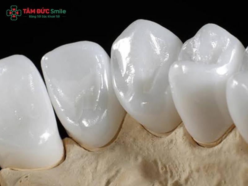Răng sứ Cercon có tốt không? Những trường hợp nên bọc răng sứ Cercon?