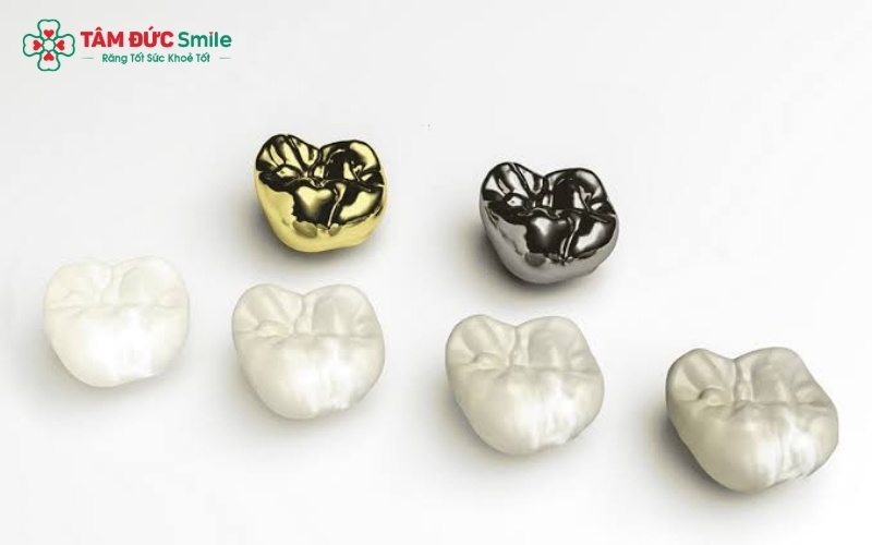 Dán răng sứ Veneer là kỹ thuật xâm lấn tối thiểu, cực kỳ an toàn khi được thực hiện đúng quy trình nha khoa.