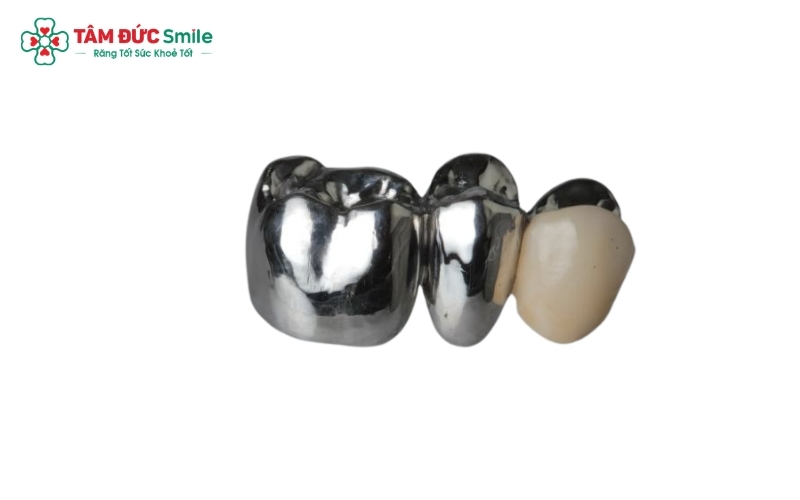 Nhờ chi phí thấp và khả năng chịu lực tốt, hai dòng răng này thường được lựa chọn để phục hình cho các răng hàm nằm phía trong không yêu cầu cao về thẩm mỹ