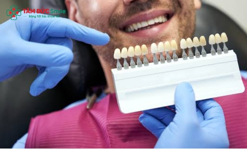  Làm răng sứ không chỉ cải thiện thẩm mỹ mà còn giúp nam giới tự tin hơn trong giao tiếp và mở rộng cơ hội thành công trong sự nghiệp.