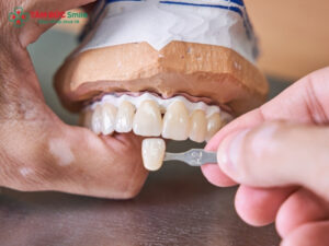 Top 7 dáng răng sứ nam đẹp, tự nhiên được ưa chuộng