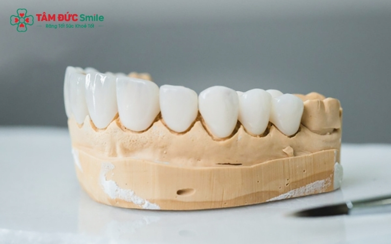 Răng sứ Roland là dòng răng toàn sứ Zirconia cao cấp, được cấu tạo từ khối sứ nguyên chất
