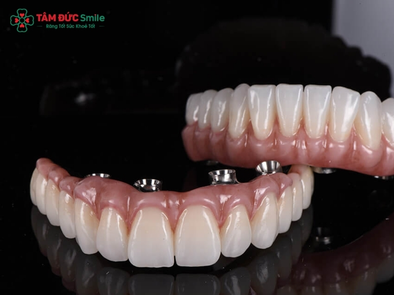 Răng sứ Titan và răng toàn sứ khác nhau gì?