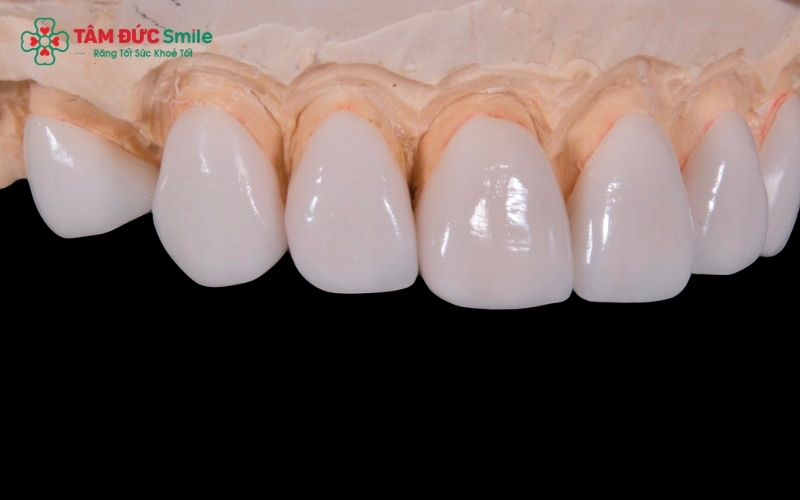 Nhờ tính tương thích sinh học xuất sắc, Zirconia HT không chỉ mang lại vẻ đẹp tự nhiên mà còn bảo vệ nướu, không gây kích ứng hay đen viền cổ răng