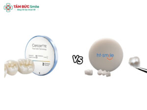 Răng sứ Cercon HT và HT Smile khác nhau thế nào? Nên chọn loại răng sứ nào?