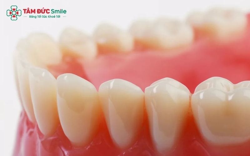 Cả hai dòng sứ đều có độ thấu quang xuất sắc, không bị bóng đen khi có ánh sáng chiếu vào, mang lại vẻ ngoài tự nhiên như răng thật.