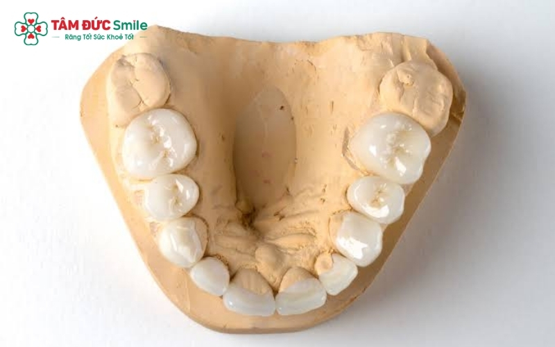 Răng sứ Zirconia thuộc dòng răng toàn sứ cao cấp, được ưa chuộng nhờ độ bền cao và tính thẩm mỹ vượt trội.