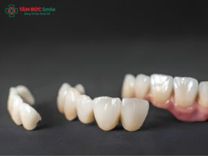 Răng sứ Zirconia và Cercon khác nhau gì? Nên chọn loại nào?