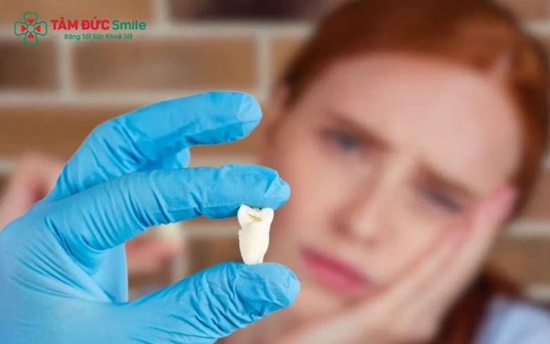 Tuyệt đối không cố gắng banh miệng quá rộng hoặc ăn thức ăn cứng quá sớm, vì điều này có thể gây sang chấn thêm cho vết thương và khớp hàm